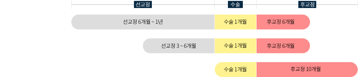 수술 시기별 양악수술 종류-선교정, 최소교정수술, 선수술