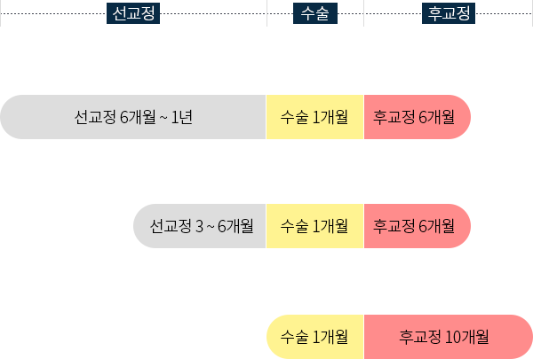 수술 시기별 양악수술 종류-선교정, 최소교정수술, 선수술